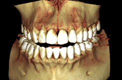 Cone-beam computed tomography (CT) image