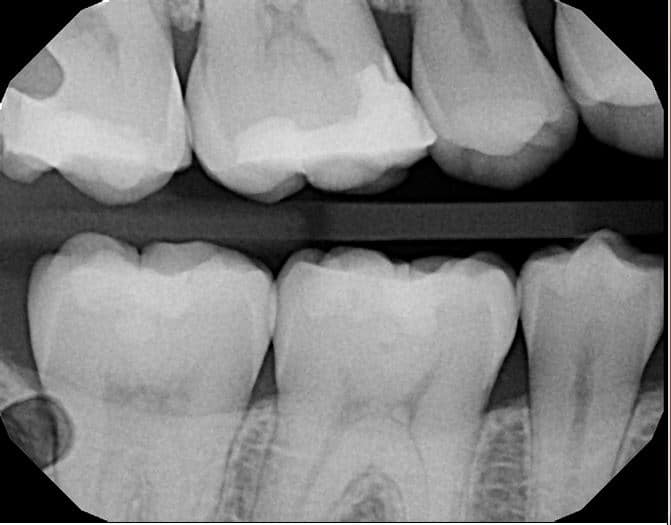 dental radiology fmx